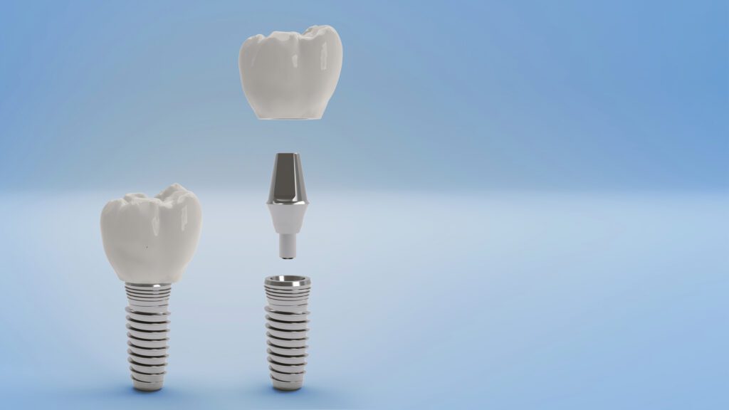 Dental Implants in Colmar, PA