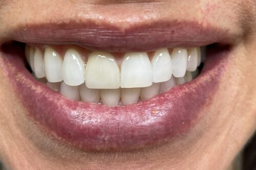 Before dentistry at Dental Health Group