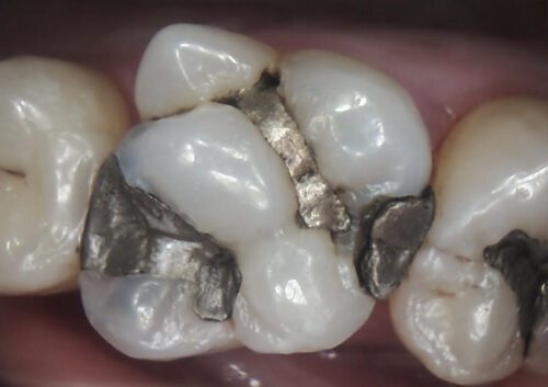 Before dentistry at Dental Health Group