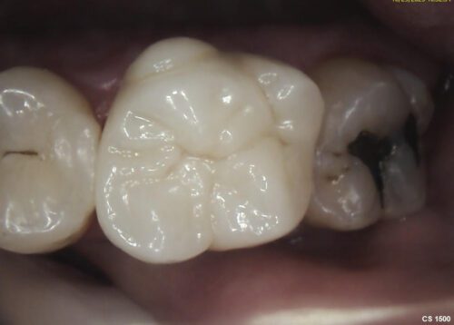 After dentistry at Dental Health Group